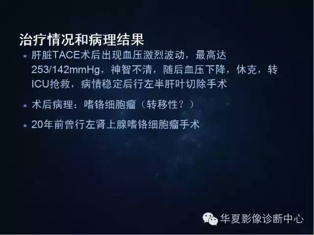 【病例】肝脏异位嗜铬细胞瘤1例影像表现