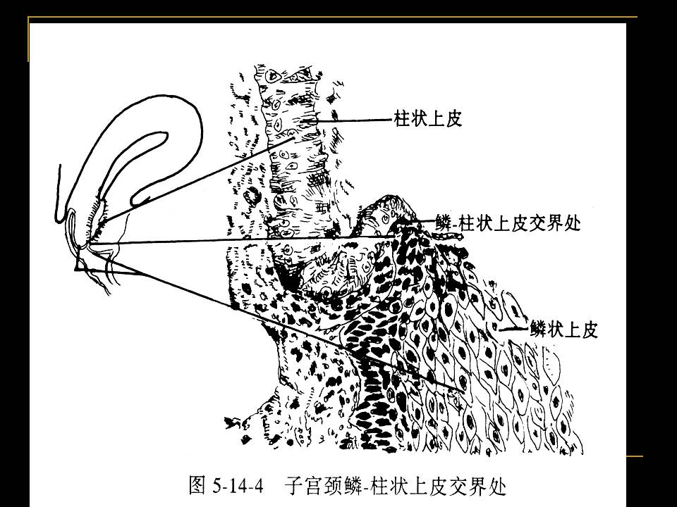幻灯片11