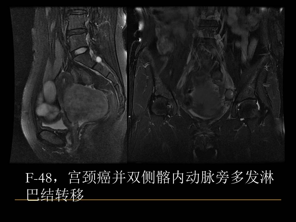 幻灯片50