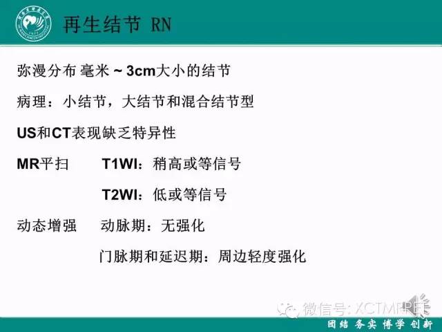 【PPT】HCC的早期诊断及CDT技术的应用