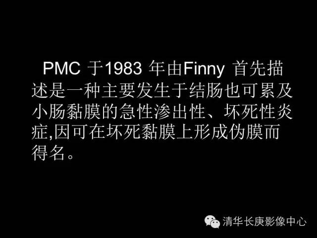 【病例】伪膜性肠炎1例CT影像表现