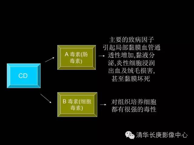 【病例】伪膜性肠炎1例CT影像表现