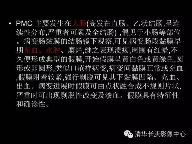 【病例】伪膜性肠炎1例CT影像表现