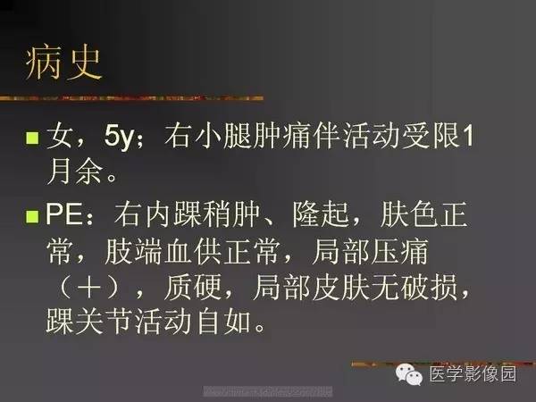 【病例】浆细胞性骨髓炎1例X线及CT影像表现