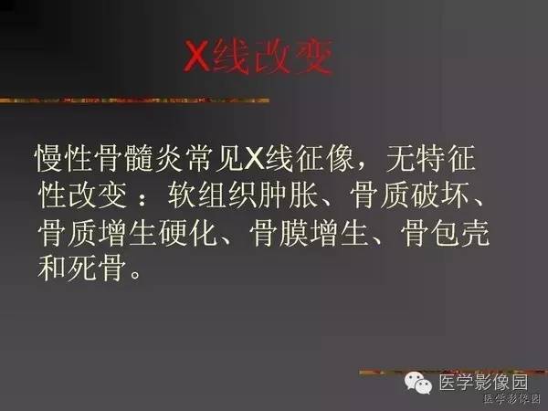 【病例】浆细胞性骨髓炎1例X线及CT影像表现