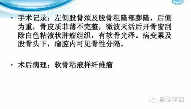 【病例】股骨软骨粘液样纤维瘤1例X线及MR影像表现