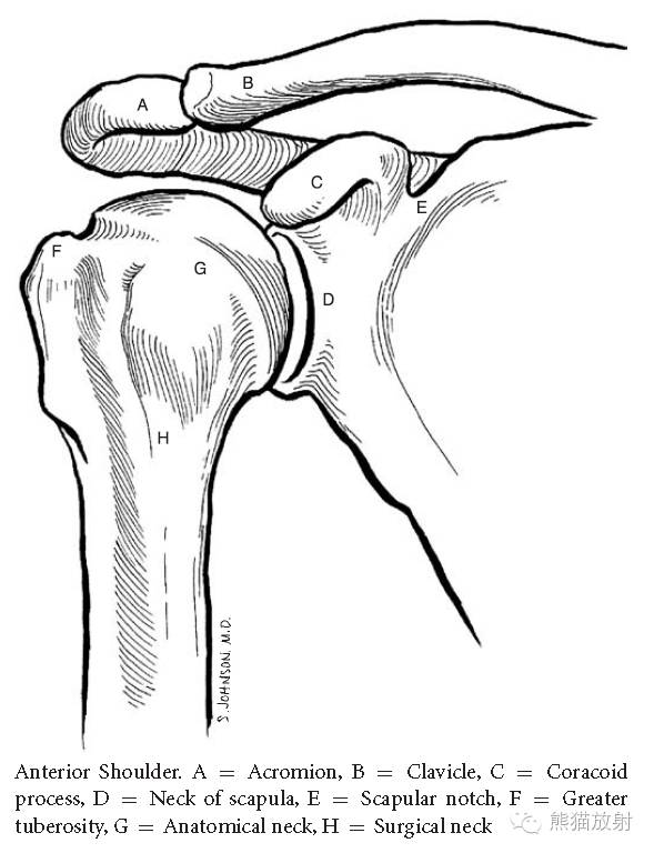 肩关节平片--临床影像示例