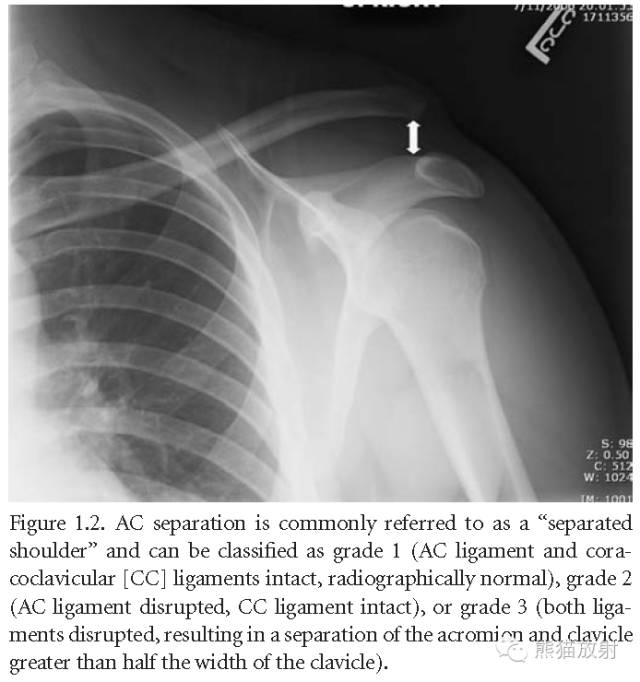 肩关节平片--临床影像示例