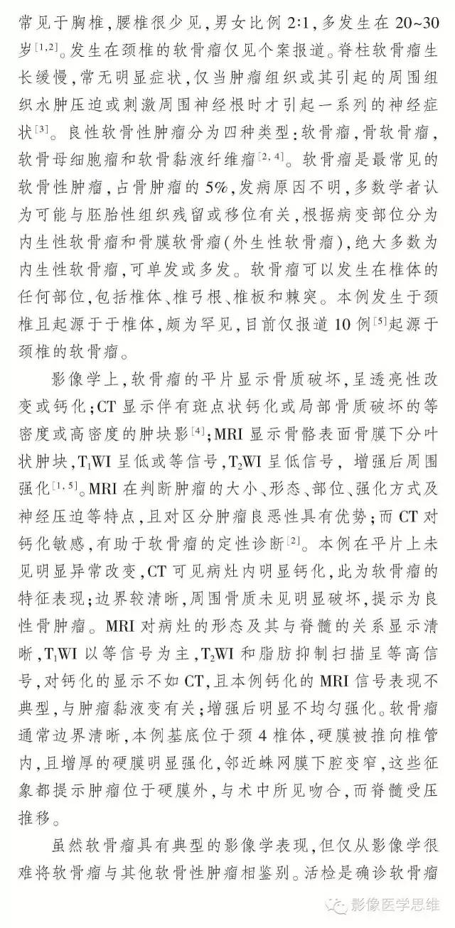 【病例】椎管内软骨瘤1例CT及MR影像表现