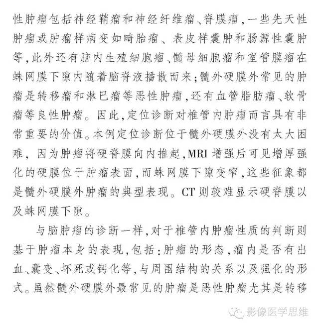 【病例】椎管内软骨瘤1例CT及MR影像表现