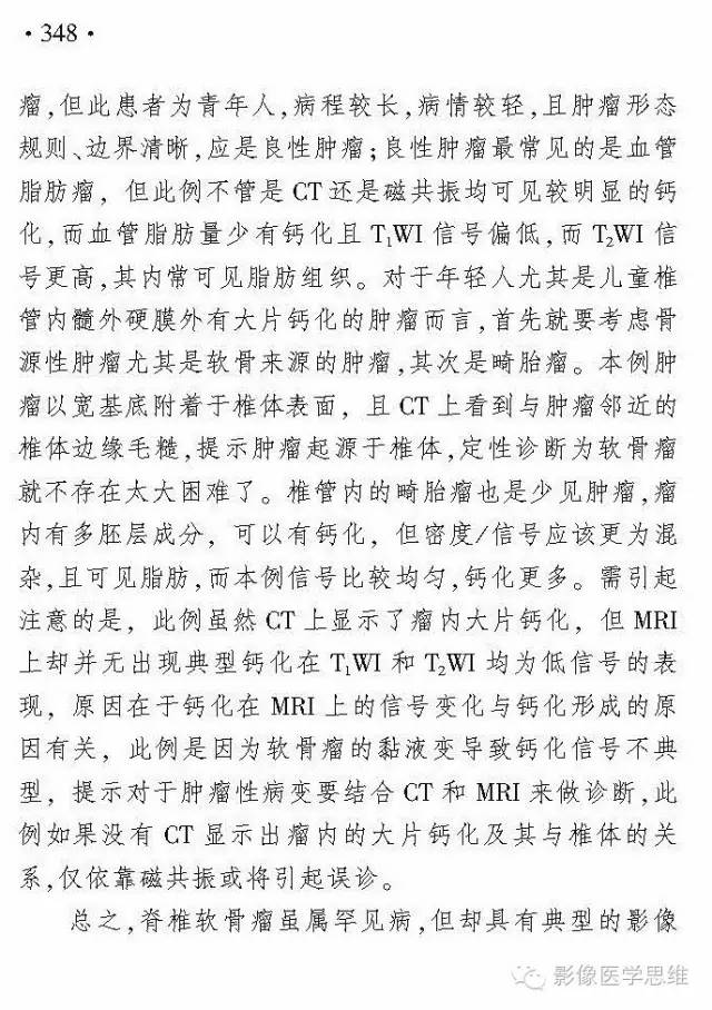 【病例】椎管内软骨瘤1例CT及MR影像表现