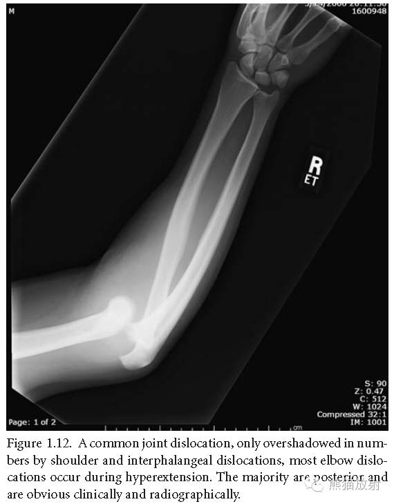 肘关节及前臂平片——临床影像示例
