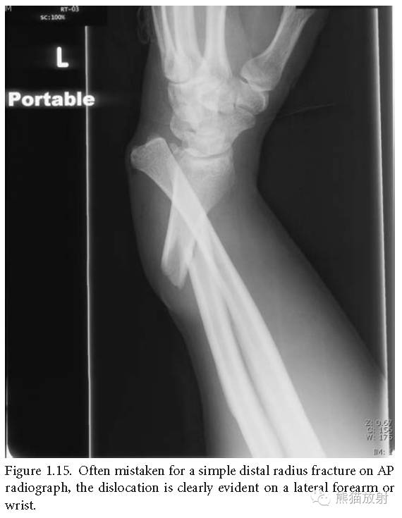 肘关节及前臂平片——临床影像示例