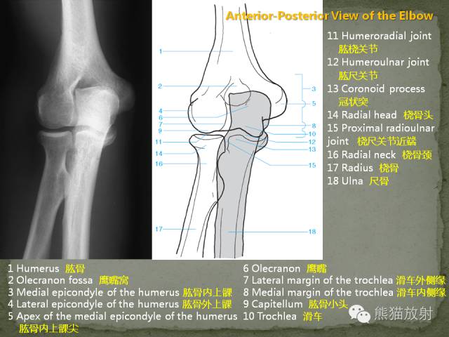 肘关节及前臂平片——临床影像示例