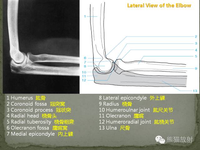 肘关节及前臂平片——临床影像示例