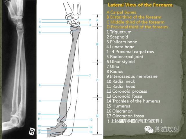 肘关节及前臂平片——临床影像示例
