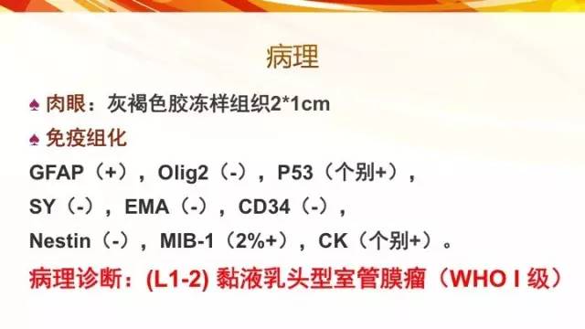 【病例】脊髓圆锥黏液乳头型室管膜瘤1例CT影像表现