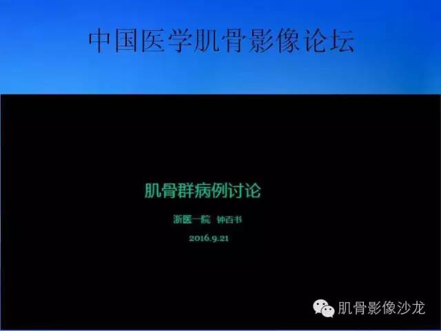 【病例】恶性外周神经鞘膜瘤1例MR影像表现