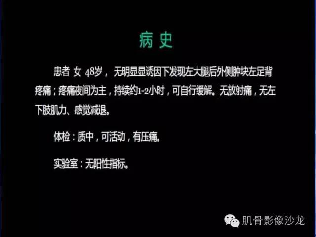 【病例】恶性外周神经鞘膜瘤1例MR影像表现