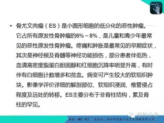 【病例】右侧髂骨Ewing肉瘤1例CT影像表现