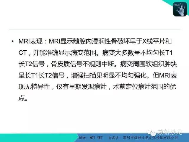 【病例】右侧髂骨Ewing肉瘤1例CT影像表现