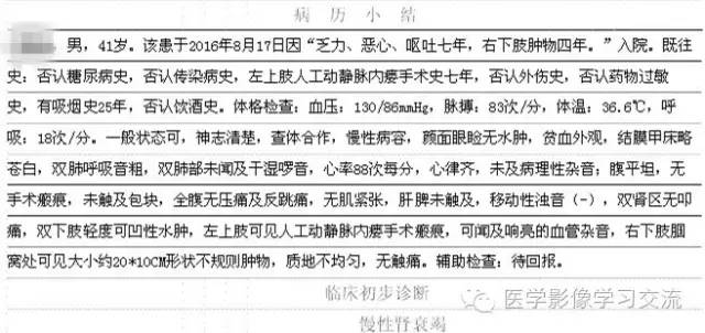 【病例】肿瘤样钙盐沉着症1例X线影像表现