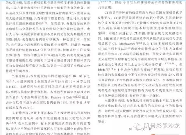 【病例】耻骨去分化软骨肉瘤一例X线及MR 【病例】耻骨去分化软骨肉瘤一例X线及MR