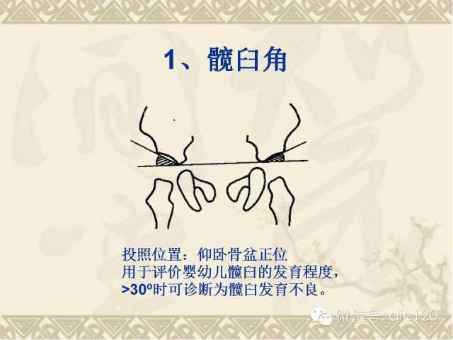 【PPT】髋关节及膝关节常用X线测量简图