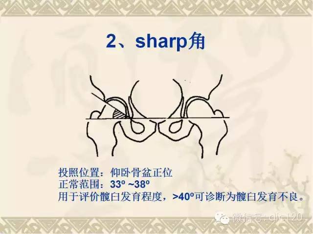 【PPT】髋关节及膝关节常用X线测量简图