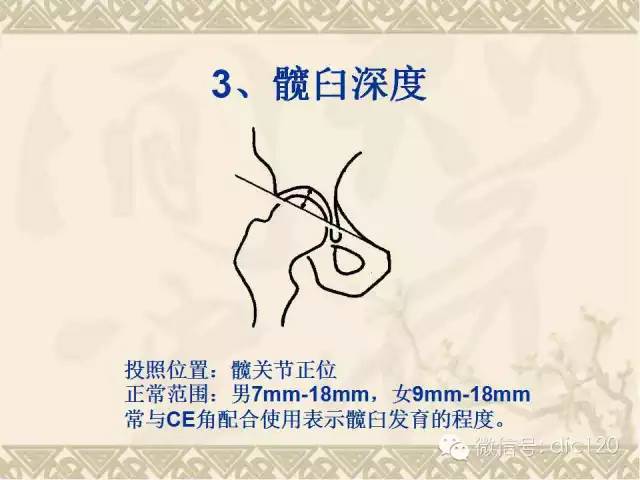 【PPT】髋关节及膝关节常用X线测量简图