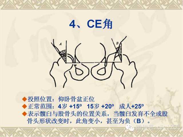 【PPT】髋关节及膝关节常用X线测量简图