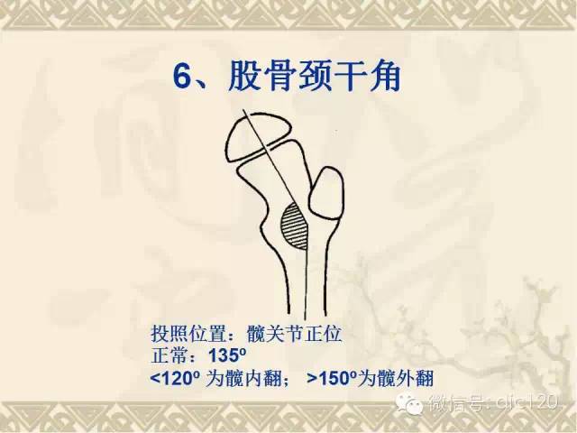 【PPT】髋关节及膝关节常用X线测量简图