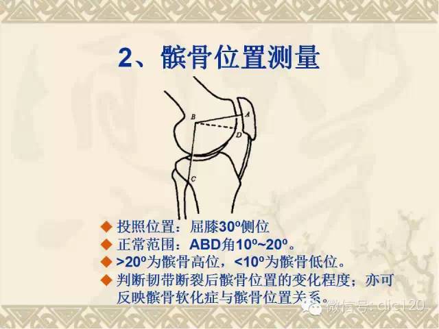 【PPT】髋关节及膝关节常用X线测量简图