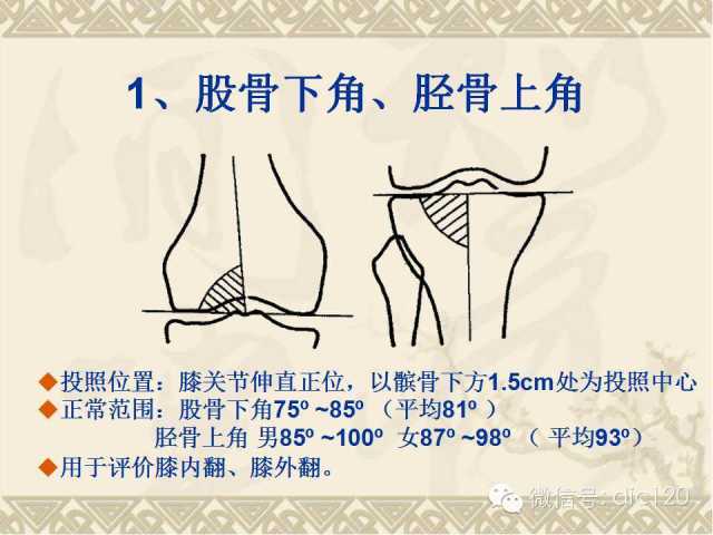 【PPT】髋关节及膝关节常用X线测量简图