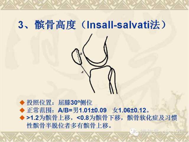 【PPT】髋关节及膝关节常用X线测量简图