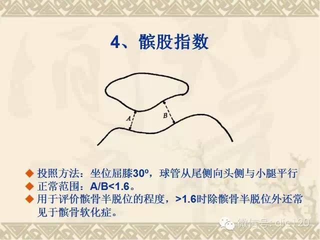 【PPT】髋关节及膝关节常用X线测量简图