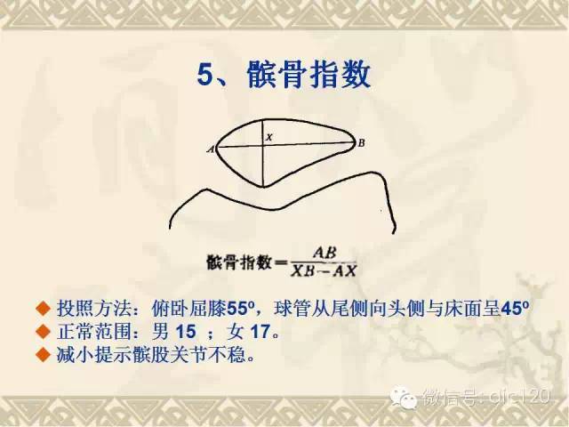 【PPT】髋关节及膝关节常用X线测量简图
