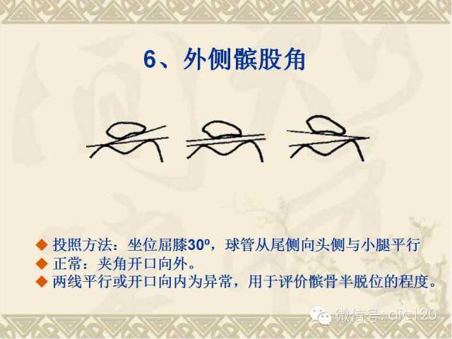 【PPT】髋关节及膝关节常用X线测量简图