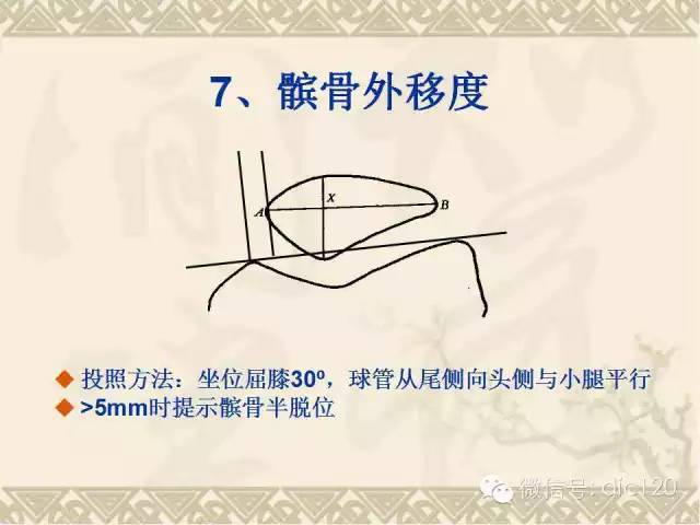 【PPT】髋关节及膝关节常用X线测量简图