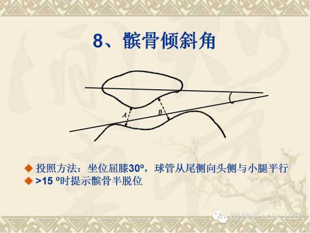 【PPT】髋关节及膝关节常用X线测量简图