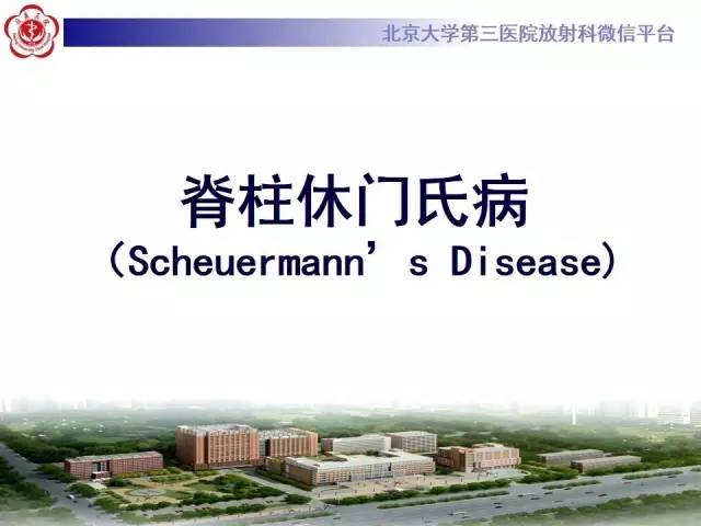 【病例】脊柱休门氏病1例X线及MR影像表现