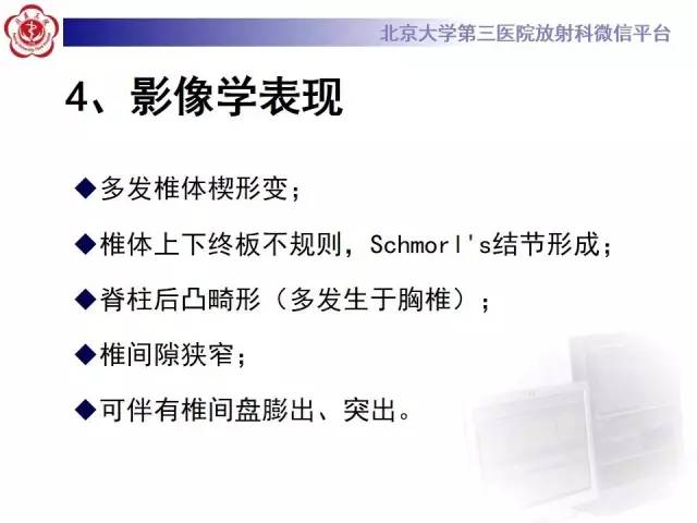 【病例】脊柱休门氏病1例X线及MR影像表现