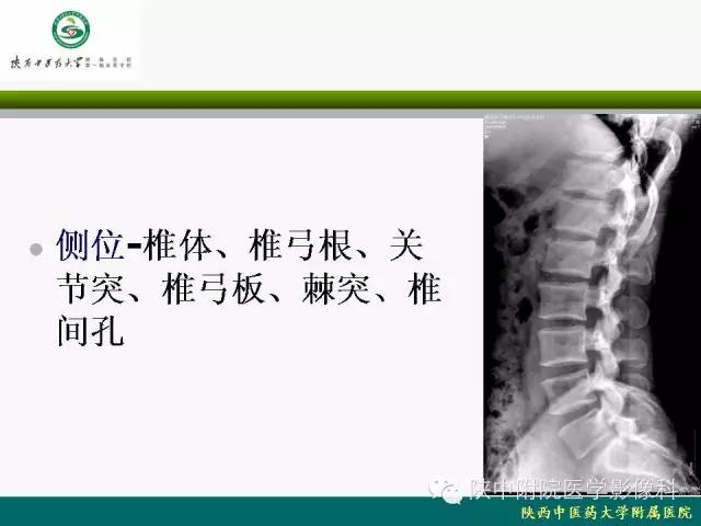 【PPT】脊柱肿瘤的影像学诊断