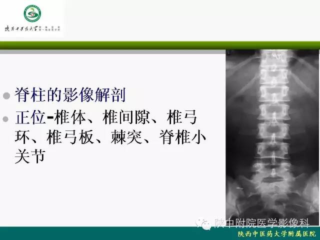 【PPT】脊柱肿瘤的影像学诊断