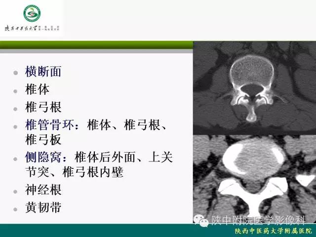 【PPT】脊柱肿瘤的影像学诊断