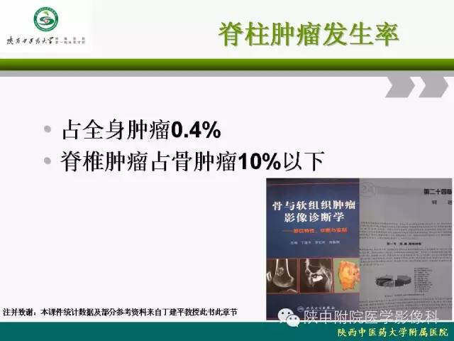 【PPT】脊柱肿瘤的影像学诊断