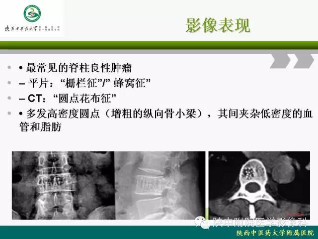 【PPT】脊柱肿瘤的影像学诊断