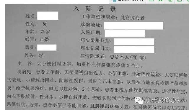 【病例】骶骨神经纤维瘤一例CT影像表现 【病例】骶骨神经纤维瘤一例CT影像表现