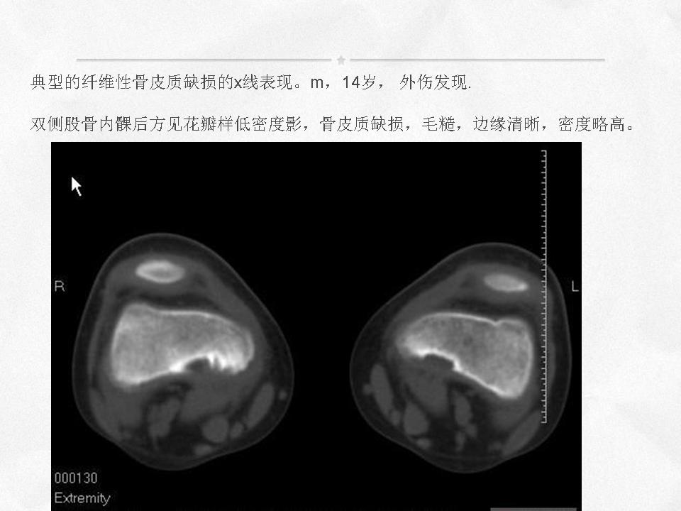 %e5%b9%bb%e7%81%af%e7%89%876