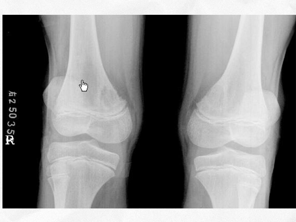 %e5%b9%bb%e7%81%af%e7%89%877